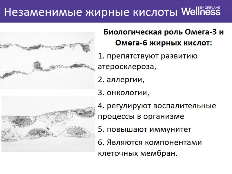 Незаменимые жирные кислоты Биологическая роль Омега-3 и Омега-6 жирных кислот:  1. препятствуют развитию